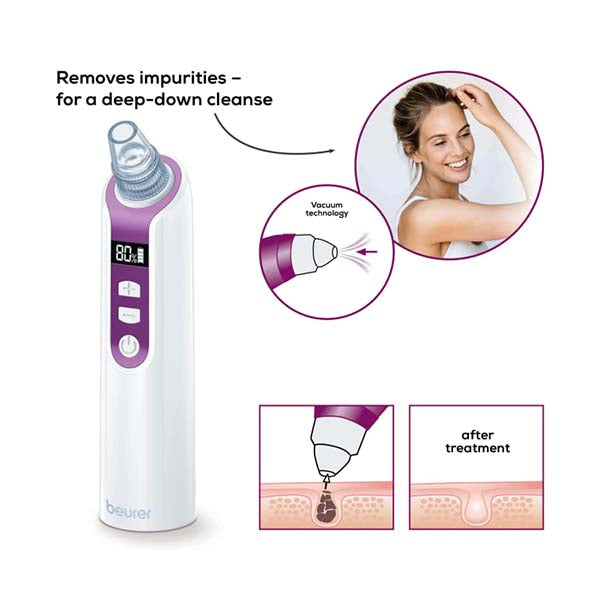 Beurer Fc 41 Pore Cleaner - 58417 - White